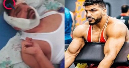 Partlayışda ağır xəsarət alan çempionun xəstəxanadan fotosu