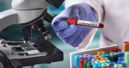 Azərbaycanda son sutkada səkkiz nəfər COVID-19-a yoluxub