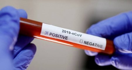 Azərbaycanda son sutkada daha 17 nəfər koronavirusa yoluxub