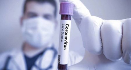 Son sutkada Azərbaycanda 502 nəfər koronavirusa yoluxub - 7 nəfər ölüb