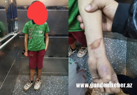 Xırdalanda ana və ata uşağa xəsarət yetirib küçəyə atıblar - FOTO