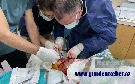 Azərbaycan Ordusunun hərbi həkimi: "Türkiyədə dağıntılar altında qalmış şəxslərin təxliyəsi üçün bizim həkimlərdən də ayrılır"