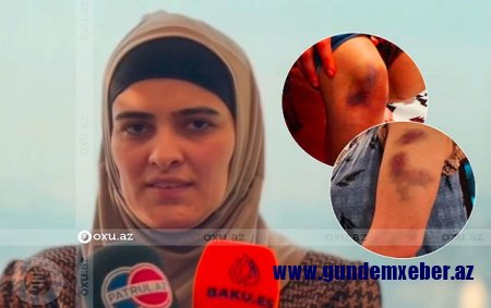 “Silahı başıma dirəyib tələb etdi ki, xəyanət etdiyimi deyim” – Polkovnik-leytenantın arvadı – Video