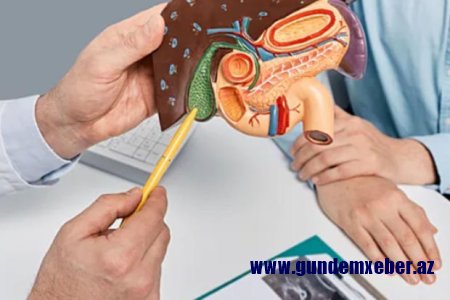 Aqressiv xərçəngin ilk simptomları aşkarlandı