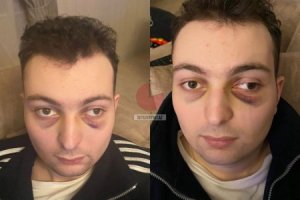 "Gənclik Mall"da autizmli gənc döyülüb, DİN araşdırmalara başlayıb - FOTO