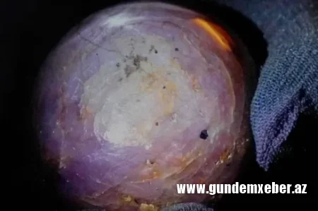 Dünyanın ən böyük sapfiri tapılıb – 3 milyard dollar qiyməti var/FOTO