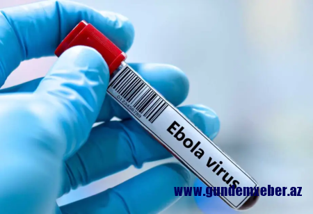 Konqoda Ebola qızdırmasından ölənlərin sayı iki min nəfəri keçib